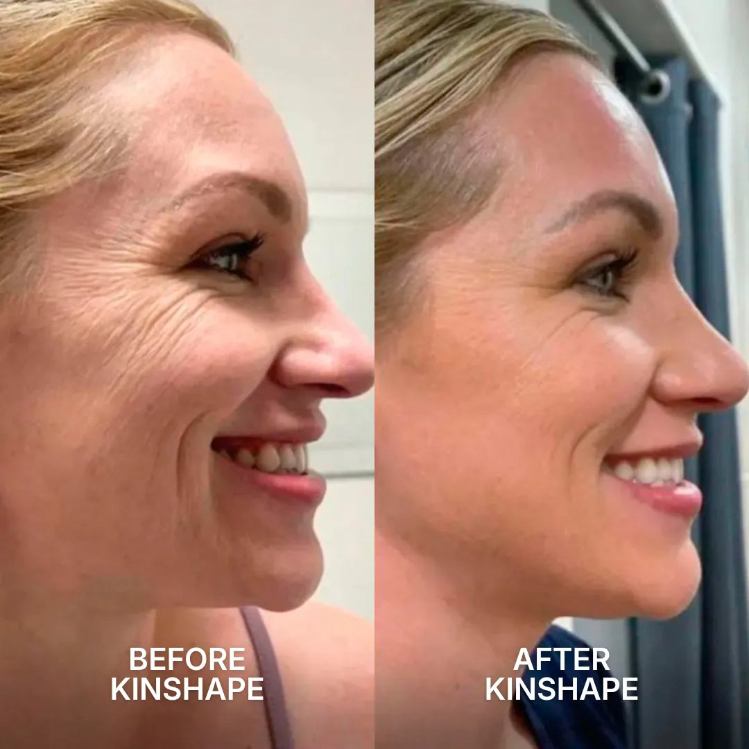 Facial Kinesiotape System