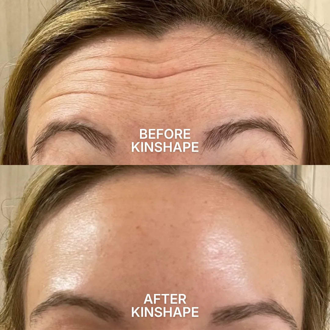 Facial Kinesiotape System
