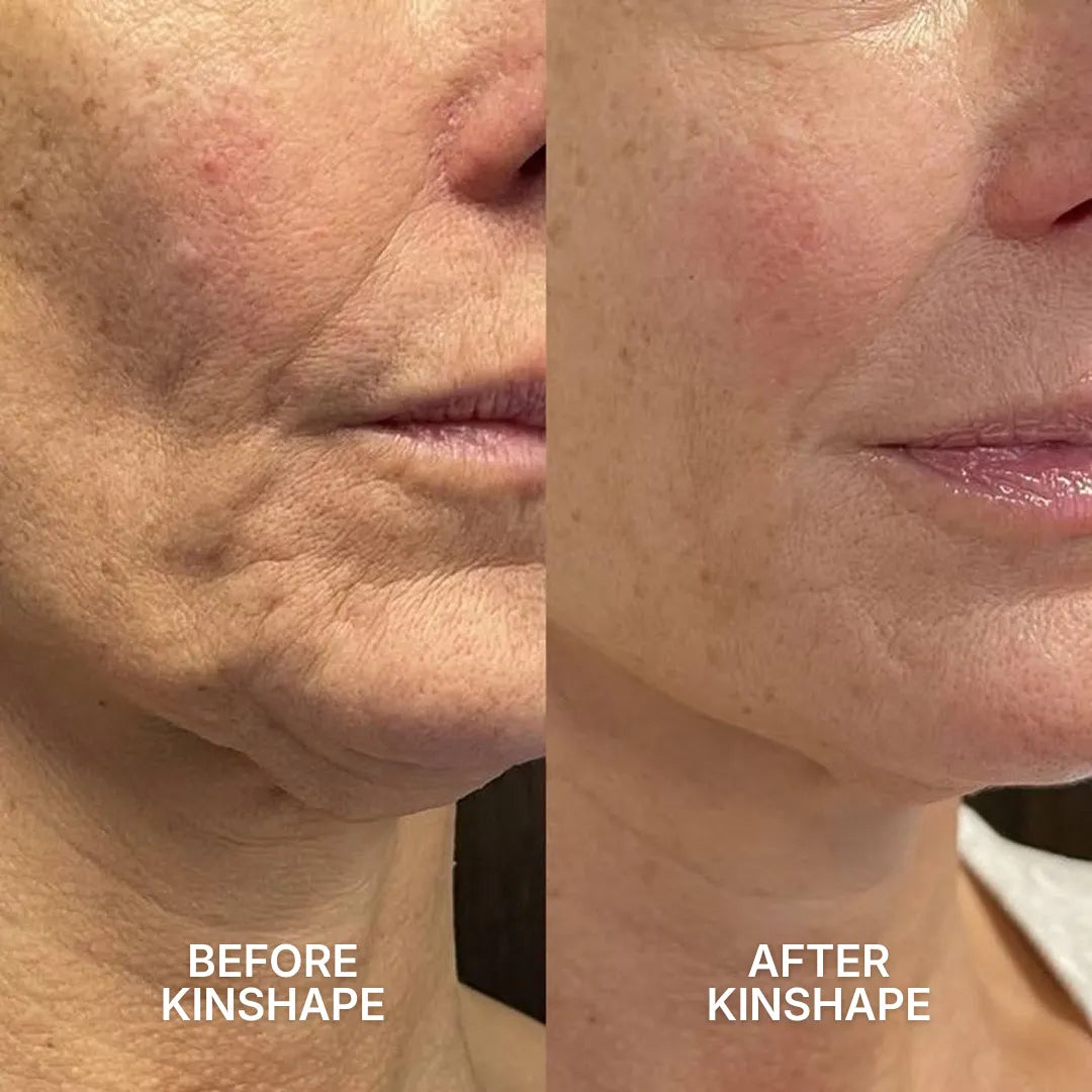 Facial Kinesiotape System